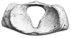 Cranialansicht des Atlasknochens eines Pottwales